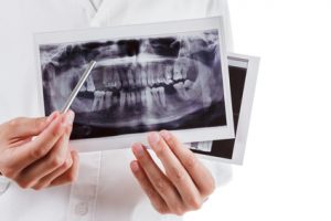 Zahnarzt erklärt ein Röntgenbild