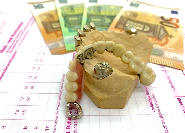 Geldscheine, Zahnprothese, HKP